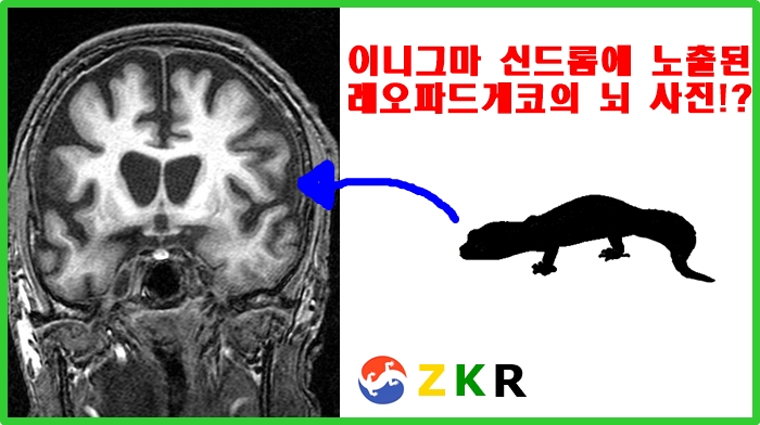 |ZKR| 레오파드게코, 이니그마 증후군(신드롬)은 인간의 '이것'과 같은 병이다.