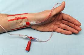  A-line 동맥라인 술기순서 삽입부위 : arterial catheter 적응증 카테터관리