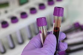  병원혈액검사 lab 결과해석 임상적의의 1편 : 혈액검사 피검사 질환