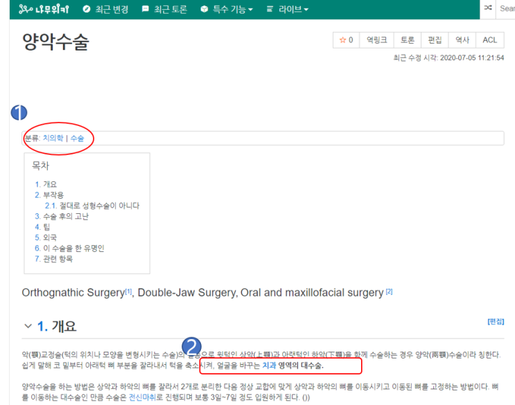 양악수술&gt; 나무위키_양악수술 키워드_ 과연 진실일까? (팩트체크)