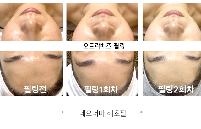  피부관리&왁싱&태닝 제주도민 최대 50% 할인쿠폰 정보! (제주시 일도동)
