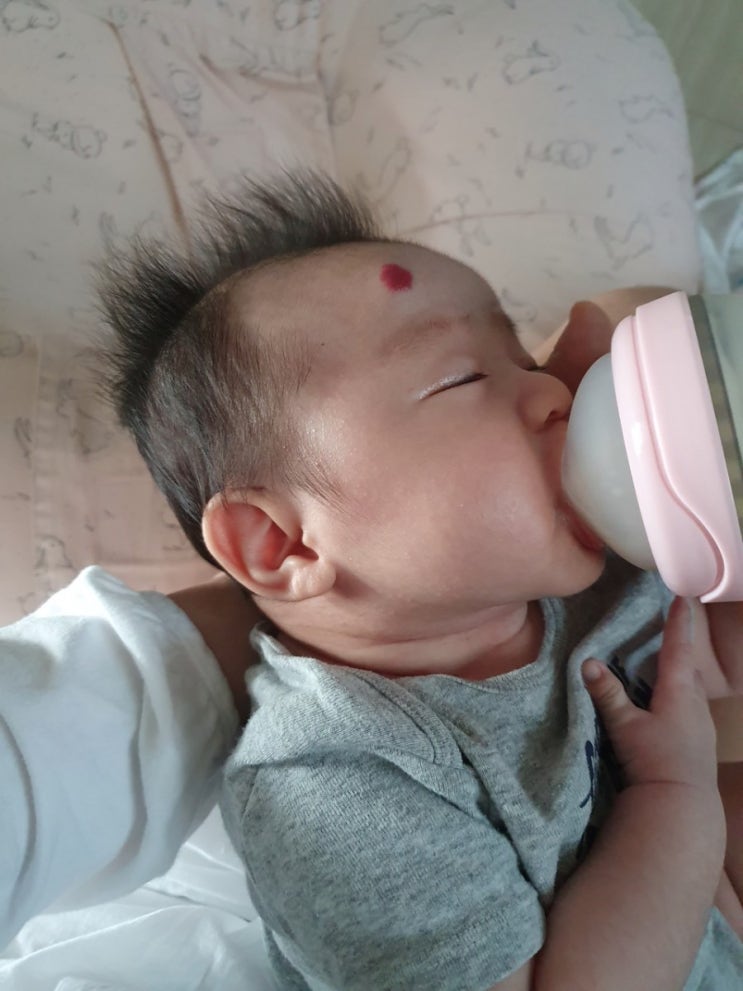  신생아질환] 생후 56일 혈관종 치료 시작