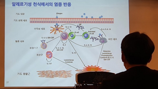 “졸레어 건강보험 적용, 중증 천식환자 삶의 질 크게 개선" “졸레어 건강보험 적용, 중증 천식환자 삶의 질 크게 개선"