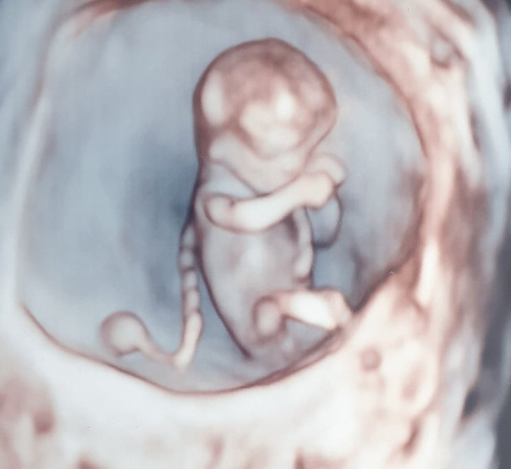 입체 초음파 사진과 임신다이어리