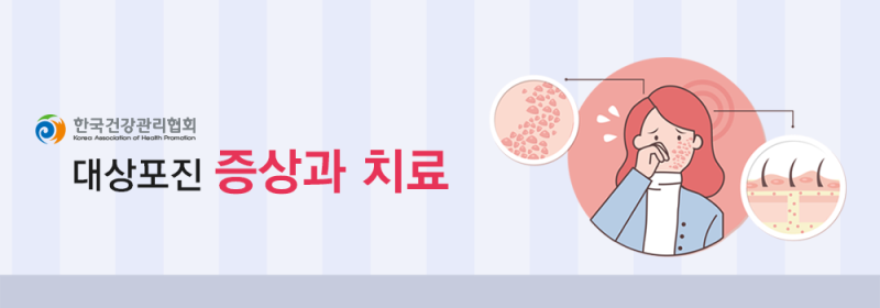 대상포진 전염성 50대 이상 위험, 13