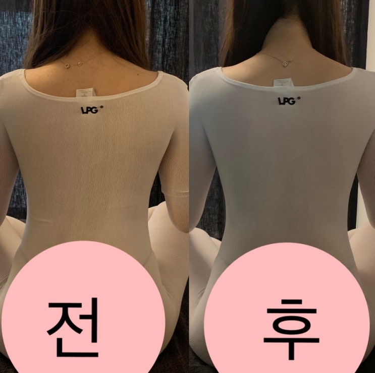  [청주,사창동] 청주다이어트 에스테티아 사창1호점 엔도몰로지 후기!!
