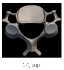  [뼈대계통 - 골학] 1. 척주(vertebrae column) - vertebrae 비교