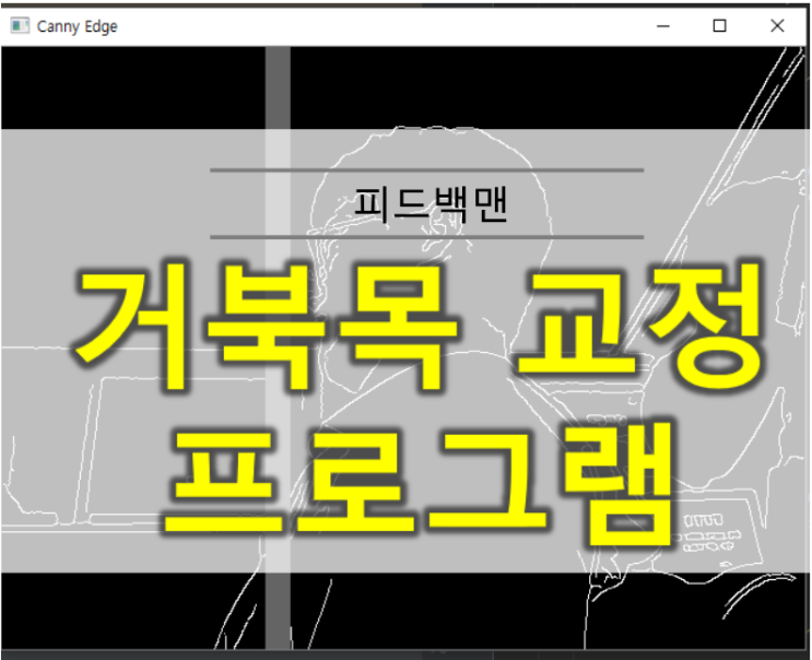  거북목 교정 프로그램
