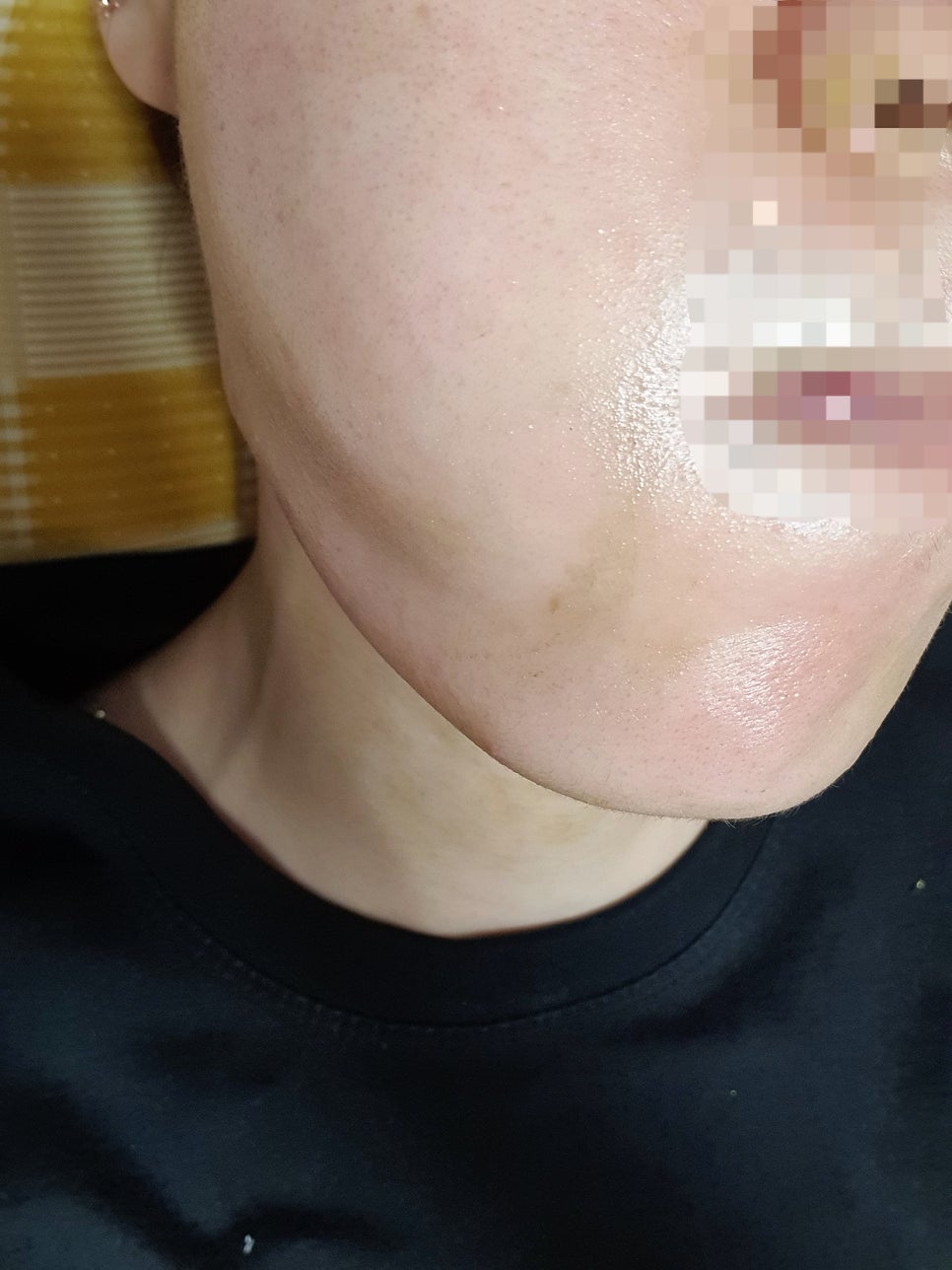 라비엘스킨케어 사진 5