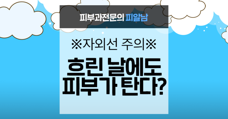  [흐린 날 자외선] 구름 낀 날 자외선이 더 세진다!