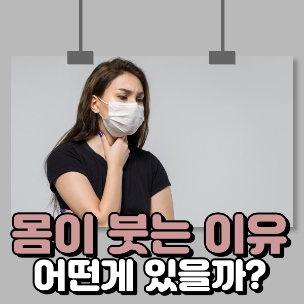  몸이 붓는 이유 어떤게 있을까?