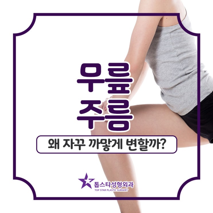  무릎 주름, 왜 자꾸 까맣게 변할까?