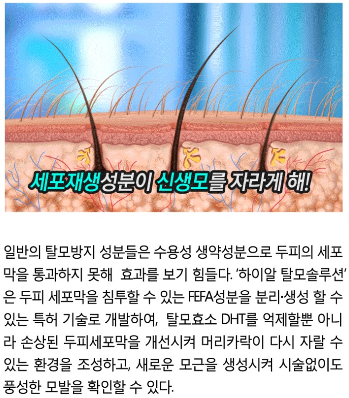 '하이알 탈모솔루션'은 두피 세포막을 침투할 수 있는 FEFA 성분을 분리, 생성할 수 있는 특허 기술로 개발하여, 탈모효소 DHT를 억제할 뿐 아니라 손상된 두피세포막을 개선