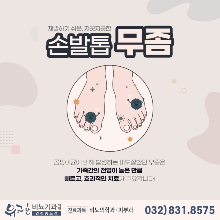 송도무좀레이저 무좀치료는 여기서 알아보세요 송도무좀레이저 무좀치료는 여기서 알아보세요
