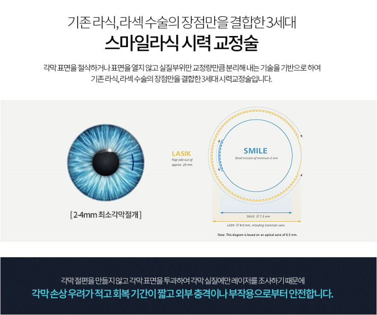 스마일라식검사 SNU서울안과에서 알아보세요 스마일라식검사 SNU서울안과에서 알아보세요