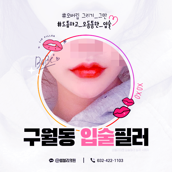 구월동피부과 인천입술필러 썸블리의원 소개합니다 구월동피부과 인천입술필러 썸블리의원 소개합니다