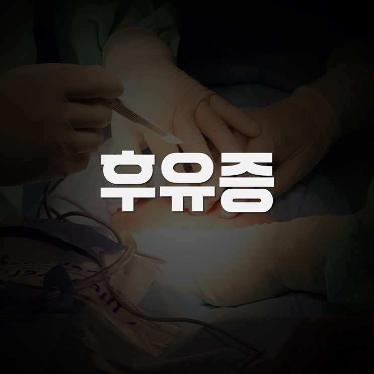 전방십자인대파열수술, 적응증 그리고 후유증? feat. 제이본정형외과 권제호