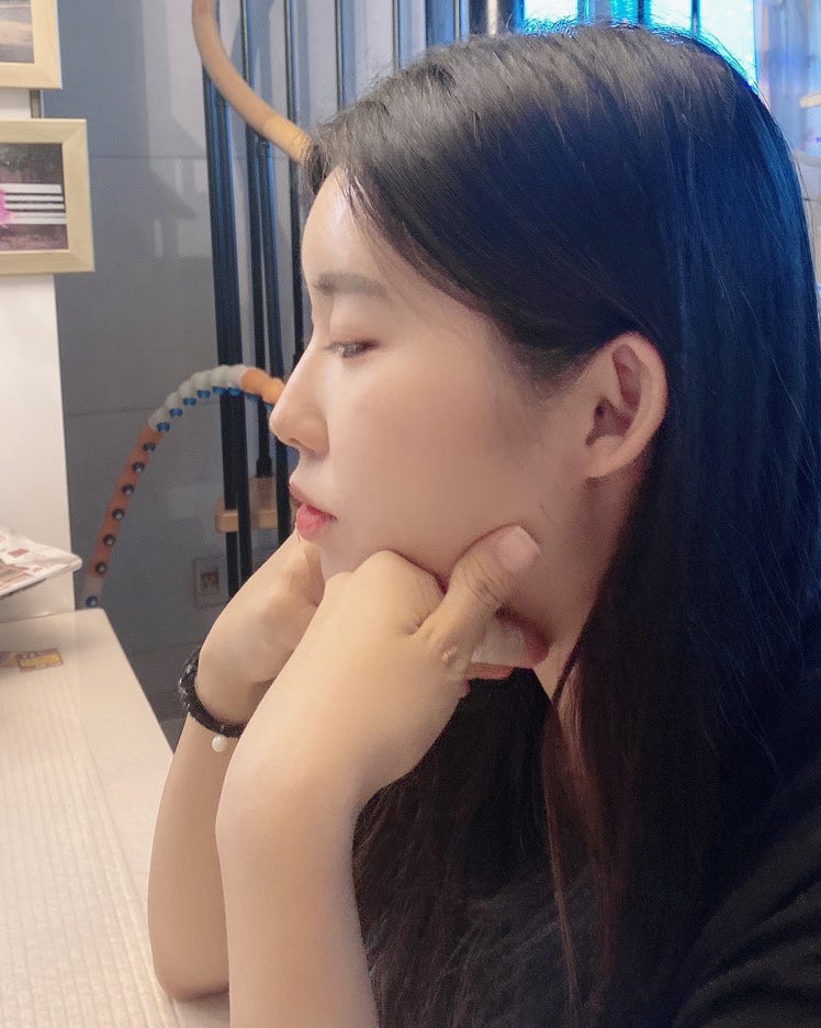 강남역 이마필러후기 6cc  ( 미간붓기 / 통증 / 유지기간 / 관자필러 / 이마필러잘하는곳 / 1일~7일차 / 정보공유 )