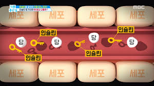  당뇨병 인슐린 종류 투여방법 주의사항 1편 : 인슐린펌프 용량 주사부위
