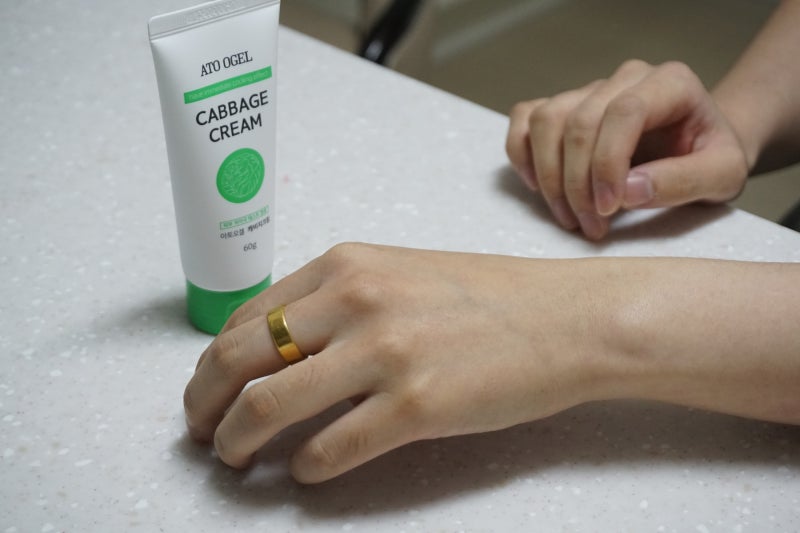 산후 유방 문제를 위한 아투겔 양배추 크림