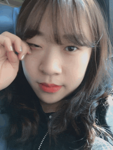  정보, 노블앤코 비절개 보조개 수술 내돈내산 2년 지난 후기_가격_비용