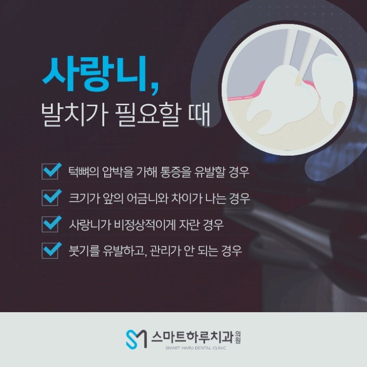  인덕원사랑니발치 사랑니발치에 대해서 알아보아요