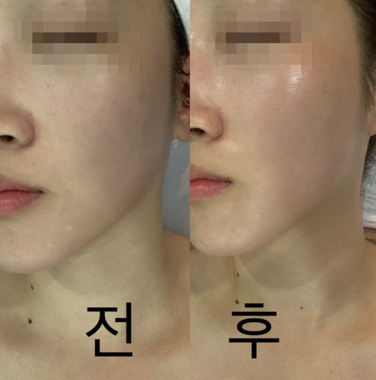  [청주,산남동]청주웨딩케어&피부관리실 금단비가청주산남점