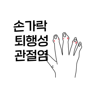 손가락이 아파요. 손가락 퇴행성 관절염. 손가락이 아파요. 손가락 퇴행성 관절염.