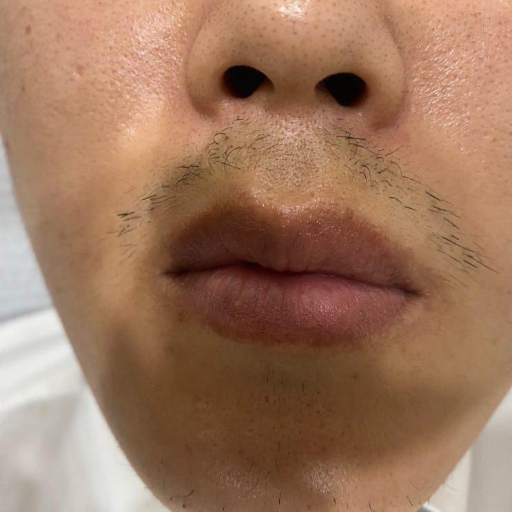  일산 장항동 정발산역 남자 브리질리언 트리플왁싱샵 다녀온 후기