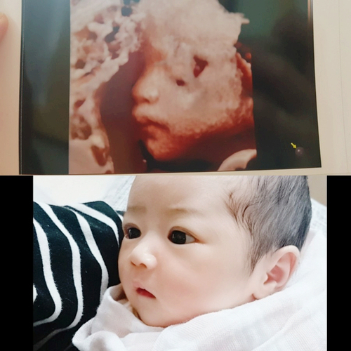  입체초음파 실물 비교!! 세상에 이렇게 비슷할 수가 ㅎㅎㅎ