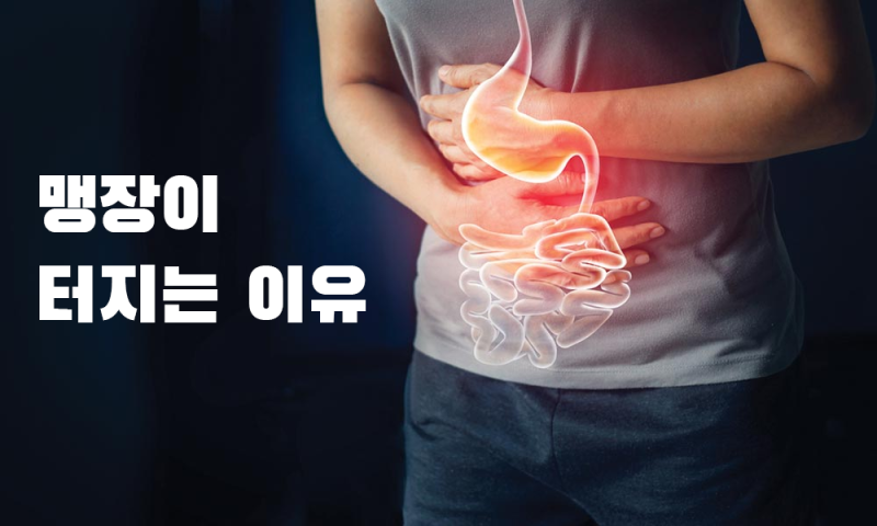 맹장염증상과 원인은 무엇일까?