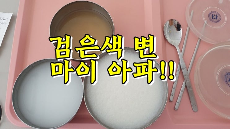  검은색 변! 흑변은 원인을 빨리 찾아야해요.