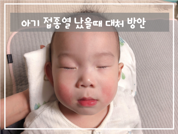  아기 접종열 났을때 대처 방안