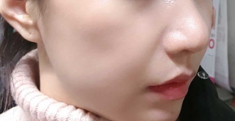 볼스컬트라 4개월 후 모습과 7
