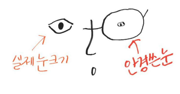  벌써 9년차 라섹수술 후기