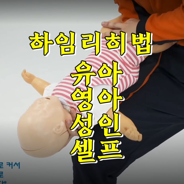  하임리히법, 유아 기도폐쇄 응급처치 제대로 알자