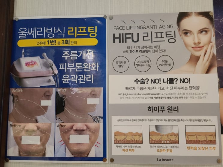  까치산역 피부관리 라보떼 - 하이푸리프팅 후기