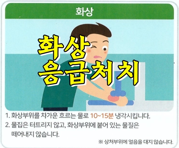  열사병, 화상 응급처치는 이렇게!