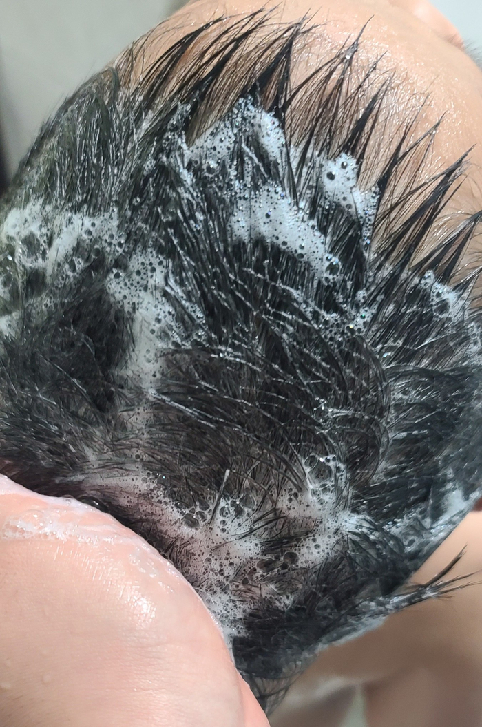  지성샴푸 추천 진짜 사용해보고 만족했던 제품 오후에 떡지는사람 모여~! ( 지루성 두피 모여~ )