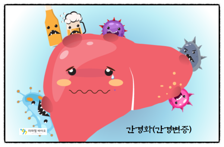  간경화(간경변증)로 몸이 괴롭다. 줄기세포치료방법 알아보자.