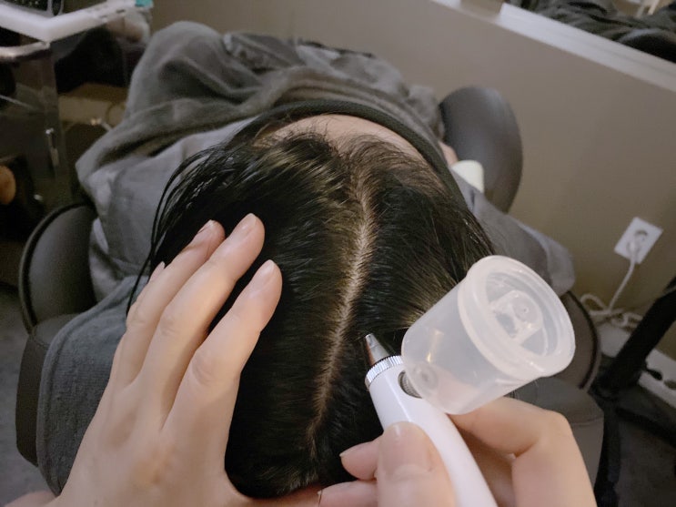  사당 탈모 / 사당역 탈모클리닉 : 탑스칼프 사당점 두피관리 후기