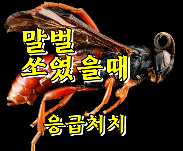  벌에 쏘였을때 응급처치 제대로 하는법