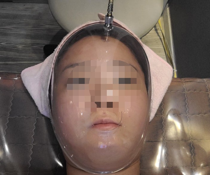 까치산역 에스테틱 라보떼 - 아쿠아필링 리뷰 3