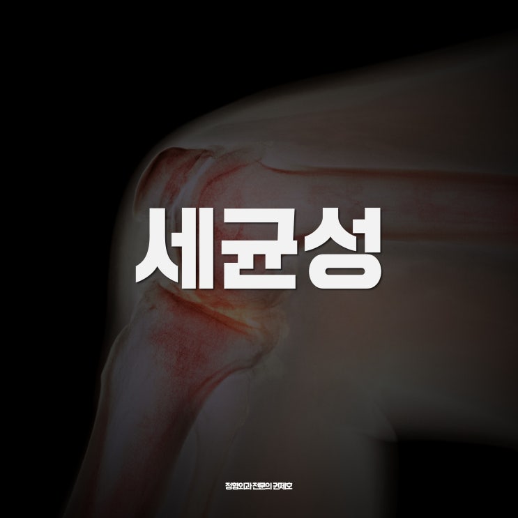  무릎 세균성 infection 관절염에서의 활막제거술