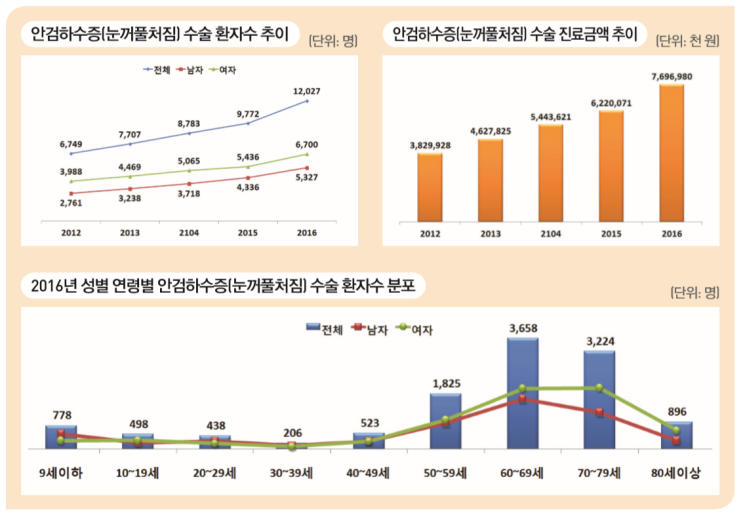  안검하수증(눈꺼풀처짐) 수술