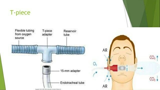 007. 신규 간호사를 위한 산소요법 (FiO2 계산, flow의 이해) : 네이버 블로그