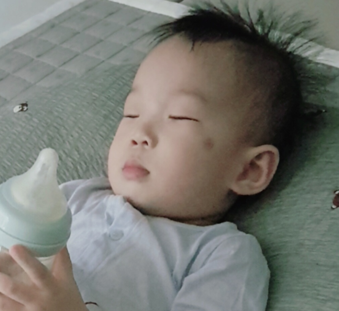  아기 모기 물린자국이 돌 이후에 갑자기 크게 부었을 경우