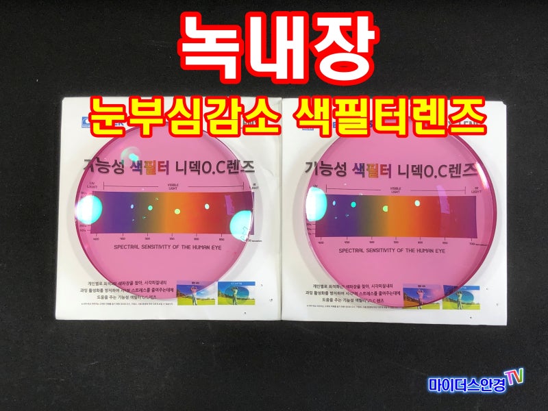 햇빛이 심하다면? 의심되는 눈병