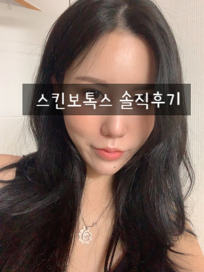 강남역피부과 스킨보톡스 풀페이스 2주경과 리얼후기 [내돈내산]