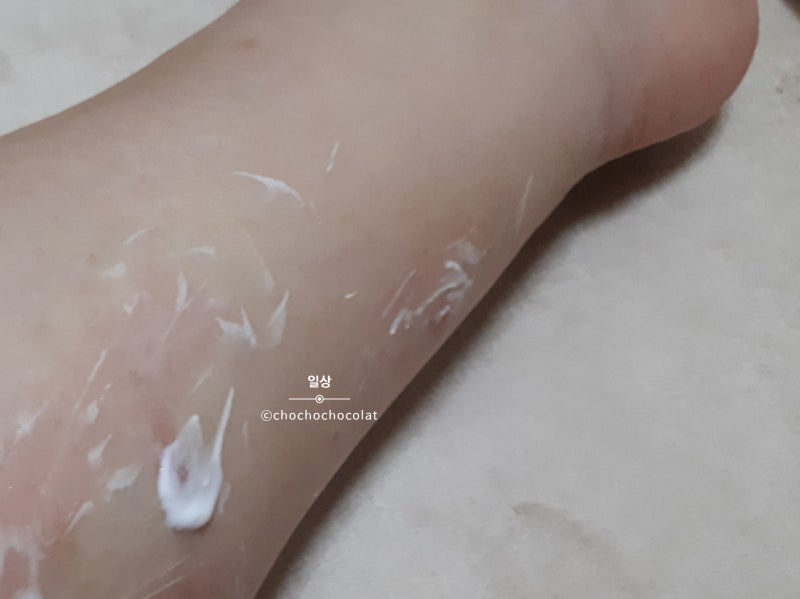 무는 파리, 샌드플라이 흡혈곤충 주의!벌레 물린 자국,대처법 : 네이버 블로그 무는 파리, 샌드플라이 흡혈곤충 주의!벌레 물린 자국,대처법 : 네이버 블로그